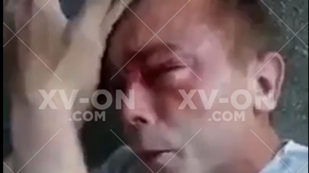 Отпинали ногами закладчика на улице ⭐ Избили кладмена до крови посреди двора ⭐ XV-ON.COM